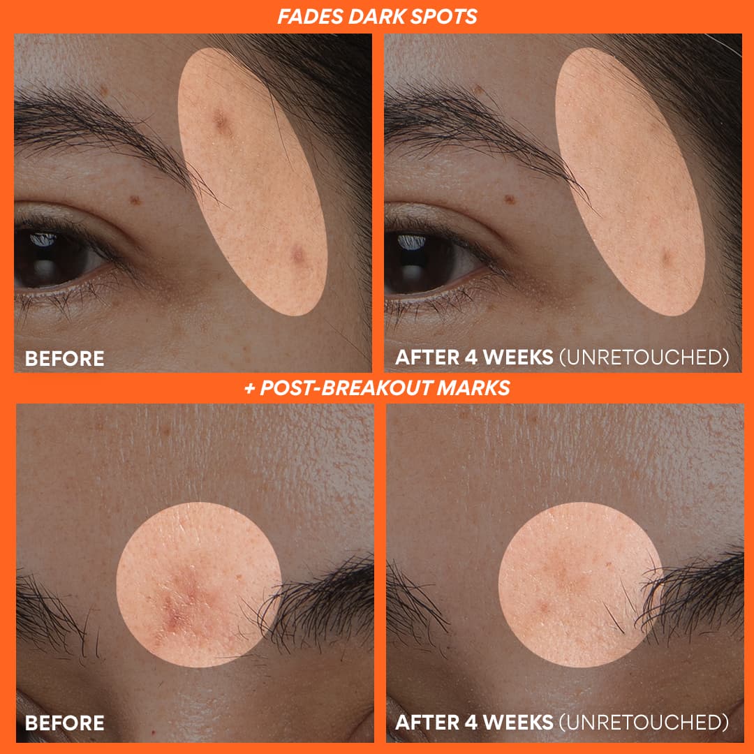 The Dewy Skin Kit